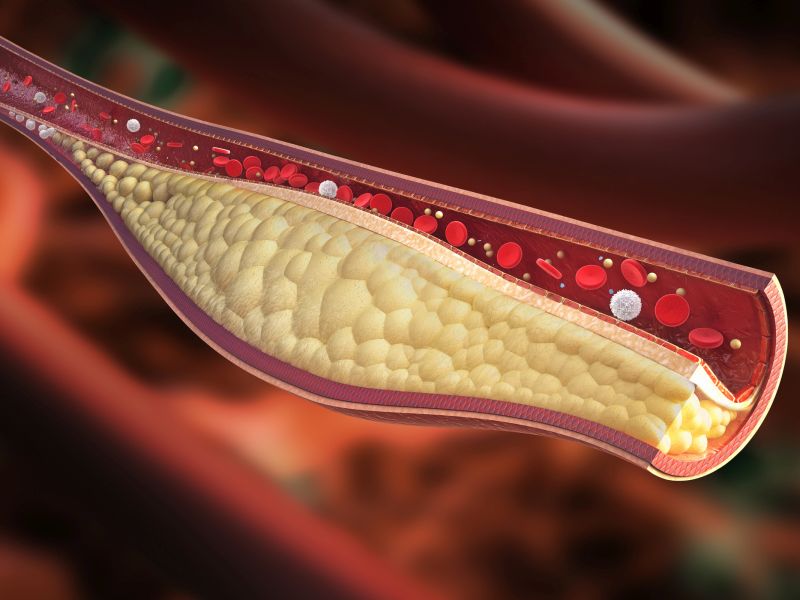 И младите здрави луѓе имаат оштетени крвни садови од загадувањето